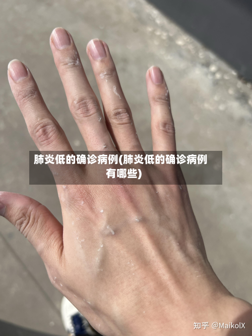 肺炎低的确诊病例(肺炎低的确诊病例有哪些)