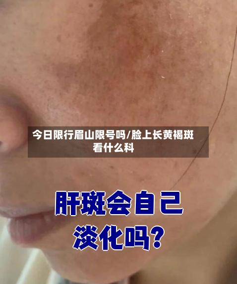 今日限行眉山限号吗/脸上长黄褐斑看什么科