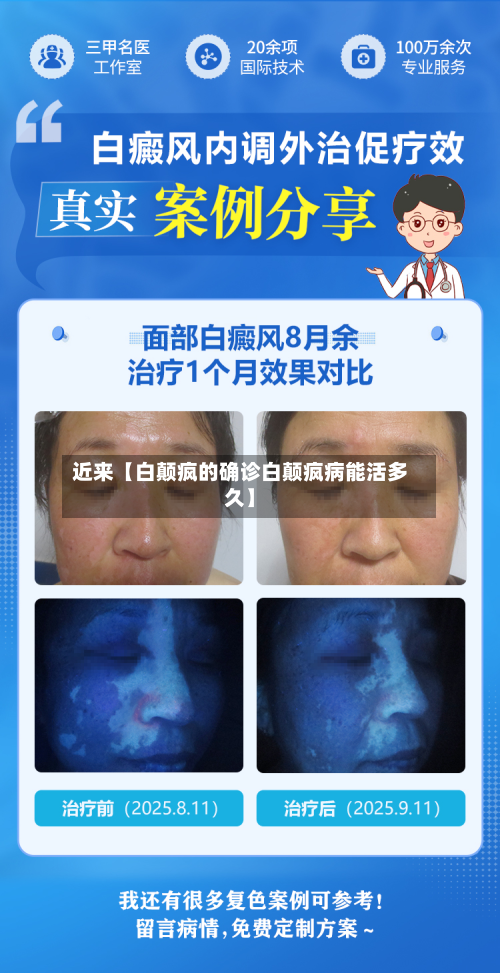 近来【白颠疯的确诊白颠疯病能活多久】